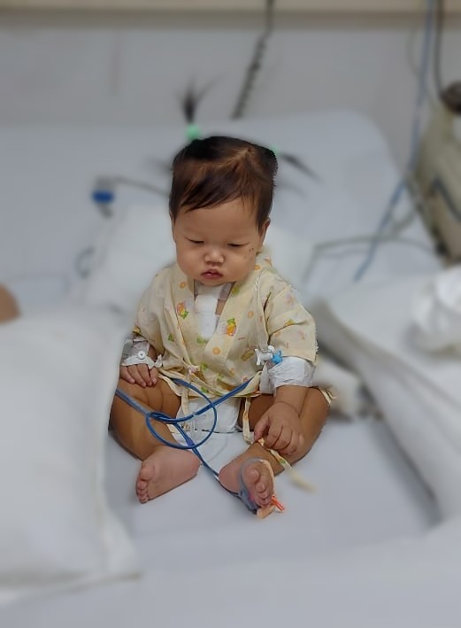  ventricular septal defect treatment in Gurgaon